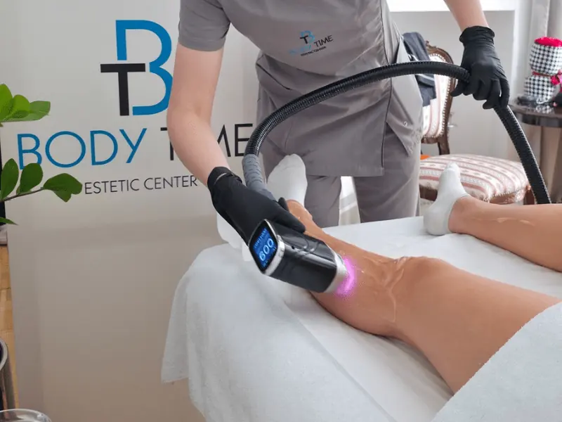 ALIAN laserska epilacija nogu u Body Time-u